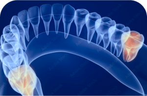 rotary endodontics - ADI